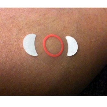 Mammography Indicator Radiolucent Circles, 12mm