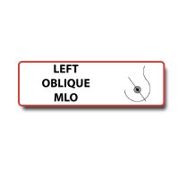 LEFT OBLIQUE MLO Permanent Adhesive Label