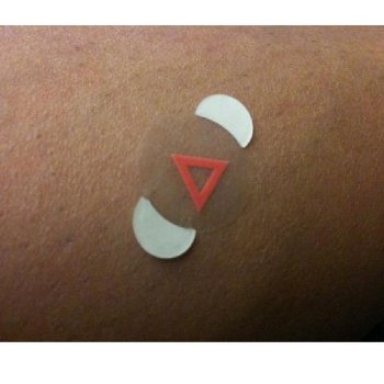 Mammography indicator Radiolucent Triangles, 10mm