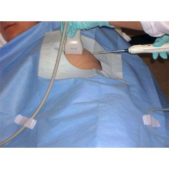 Ultrasound Sterile Biopsy Drape
